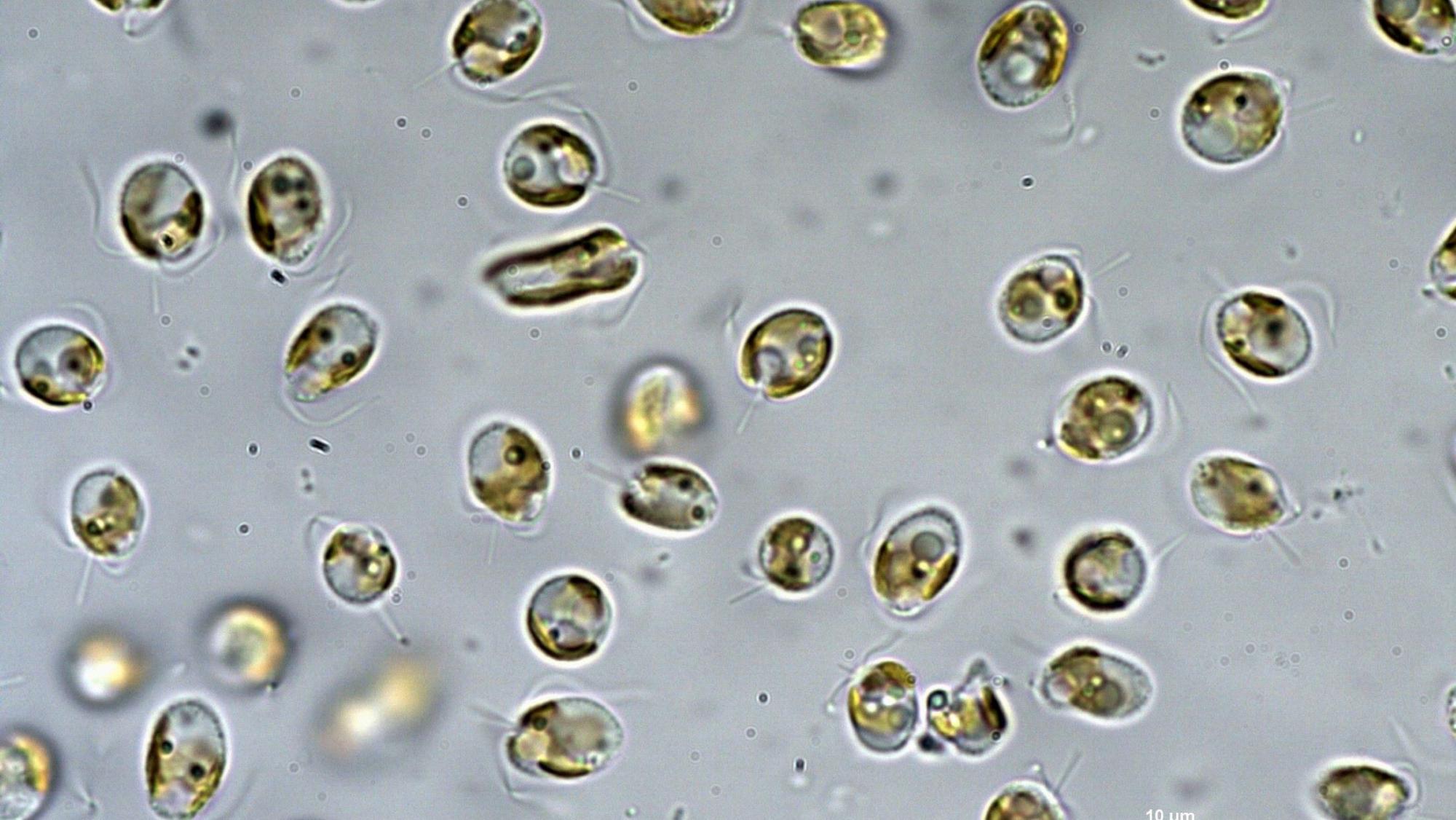 Prymnesium parvum